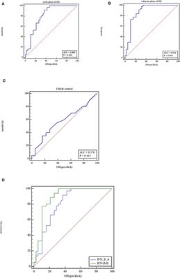 Combined IFN-β and PLT Detection Can Identify Kawasaki Disease Efficiently